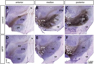 Evidence for Sprouting of Dopamine and Serotonin Axons in the Pallidum of Parkinsonian Monkeys